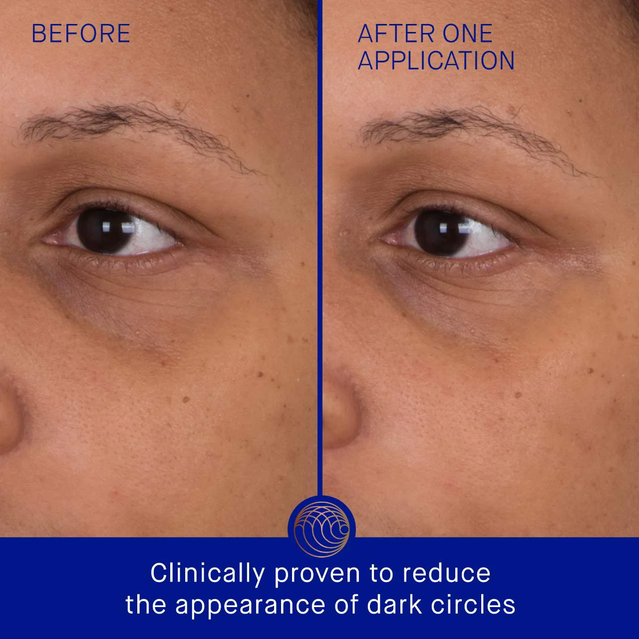 Augustinus Bader The Eye Patches